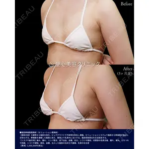 聖心美容クリニック 横浜院 佐々木 直美医師の症例