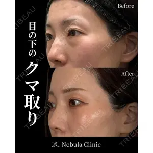 愛知春日井美容外科ネビュラクリニック 都築 諒医師の症例
