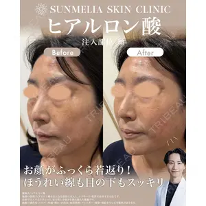 SUNMELIA SKIN CLINIC 中山 暁医師の症例
