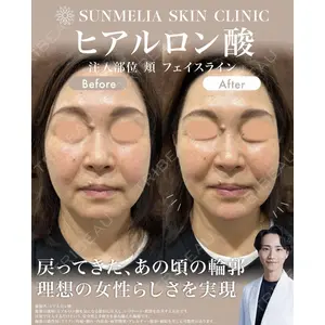 SUNMELIA SKIN CLINICの症例