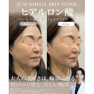 SUNMELIA SKIN CLINICの症例
