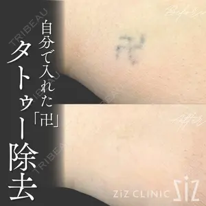 ziz CLINIC 村岡 史子医師の症例