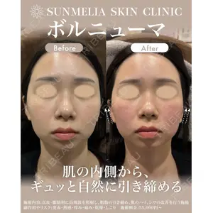 SUNMELIA SKIN CLINICの症例