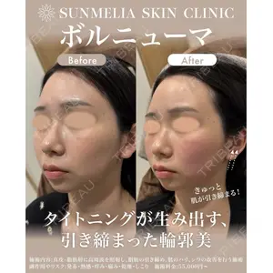 SUNMELIA SKIN CLINICの症例