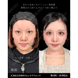 新宿美容外科ネビュラクリニック 山本 紘子医師の症例