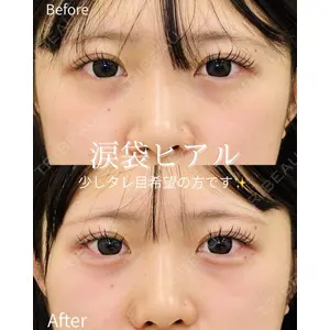 ルラ美容クリニック 仙台院 / ルラスキンクリニック 仙台院 橋本 英樹医師の症例