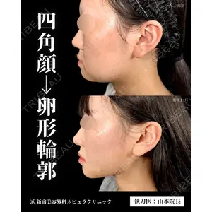 新宿美容外科ネビュラクリニック 山本 紘子医師の症例