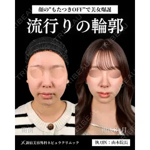 新宿美容外科ネビュラクリニック 山本 紘子医師の症例
