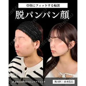 新宿美容外科ネビュラクリニック 山本 紘子医師の症例