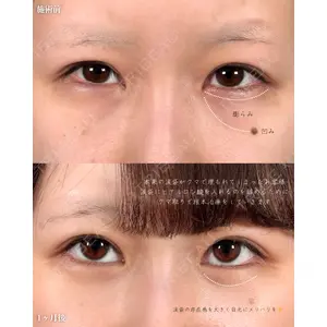 新宿美容外科ネビュラクリニック 山本 紘子医師の症例