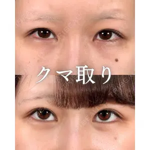 新宿美容外科ネビュラクリニック 山本 紘子医師の症例