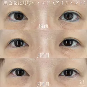 ziz CLINIC 村岡 史子医師の症例