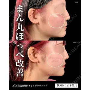 新宿美容外科ネビュラクリニック 山本 紘子医師の症例