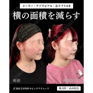 新宿美容外科ネビュラクリニック 山本 紘子医師の症例