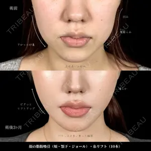 新宿美容外科ネビュラクリニック 山本 紘子医師の症例