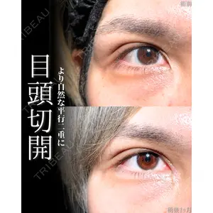 新宿美容外科ネビュラクリニック 山本 紘子医師の症例