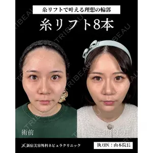 新宿美容外科ネビュラクリニック 山本 紘子医師の症例