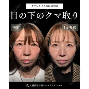 札幌美容外科ネビュラクリニック 横田 開医師の症例
