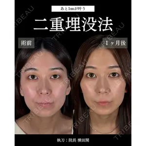 札幌美容外科ネビュラクリニック 横田 開医師の症例