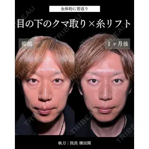 札幌美容外科ネビュラクリニック 横田 開医師の症例