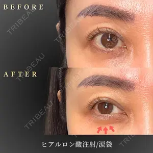 BiBiクリニック 山本 幸一郎医師の症例