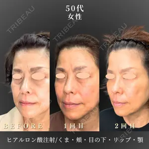 BiBiクリニック 山本 幸一郎医師の症例