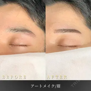 BiBiクリニック 山本 幸一郎医師の症例