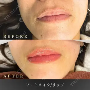 BiBiクリニックの症例