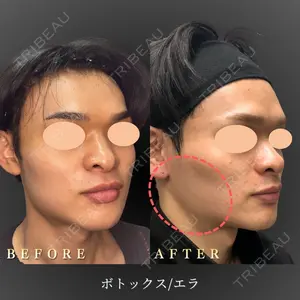 BiBiクリニック 山本 幸一郎医師の症例