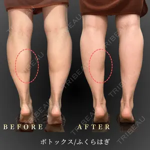 BiBiクリニック 山本 幸一郎医師の症例