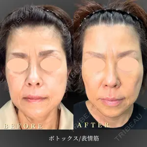 BiBiクリニック 山本 幸一郎医師の症例