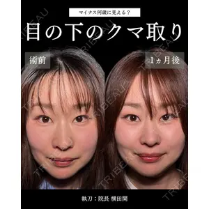 札幌美容外科ネビュラクリニック 横田 開医師の症例