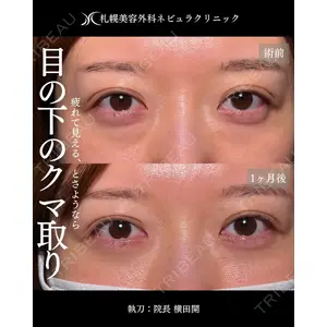 札幌美容外科ネビュラクリニック 横田 開医師の症例