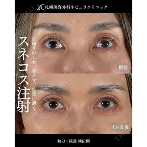 札幌美容外科ネビュラクリニック 横田 開医師の症例