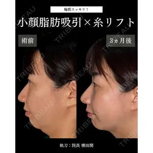 札幌美容外科ネビュラクリニック 横田 開医師の症例