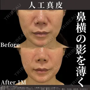 EMMO FACE CLINIC 東京三田院 木之下 哲彦医師の症例