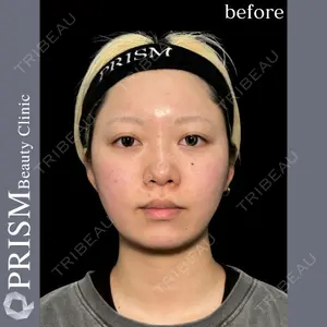 PRISM Beauty Clinic 町田院 森本 理一郎医師の症例