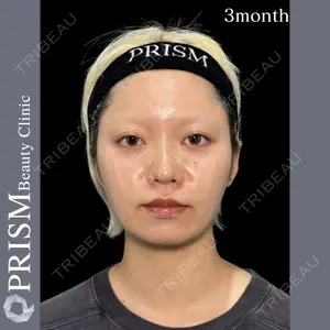 PRISM Beauty Clinic 町田院 森本 理一郎医師の症例