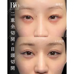 BITO BEAUTY CLINICの症例