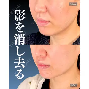 神戸美容外科 ネビュラクリニック 岩﨑 雅医師の症例