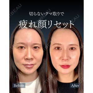 神戸美容外科 ネビュラクリニック 岩﨑 雅医師の症例