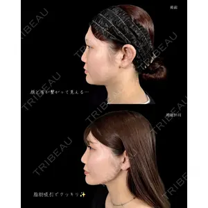 新宿美容外科ネビュラクリニックの症例