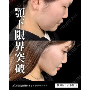 新宿美容外科ネビュラクリニックの症例