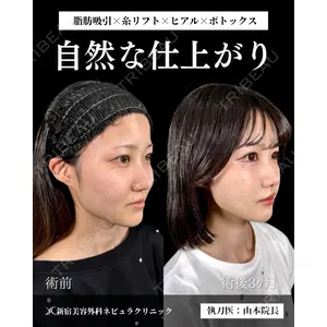 新宿美容外科ネビュラクリニック 山本 紘子医師の症例
