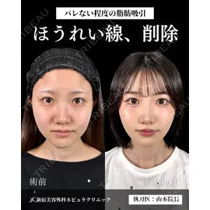 新宿美容外科ネビュラクリニック 山本 紘子医師の症例