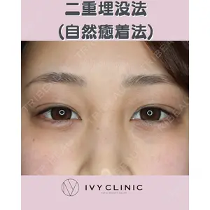 千葉美容外科アイビークリニックの症例