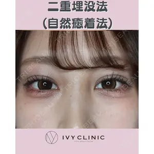 千葉美容外科アイビークリニックの症例