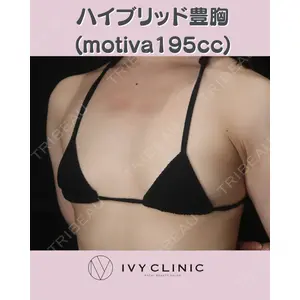 千葉美容外科アイビークリニックの症例