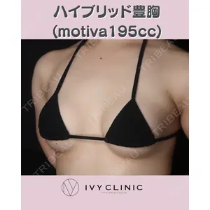 千葉美容外科アイビークリニックの症例