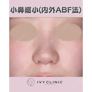 千葉美容外科アイビークリニックの症例